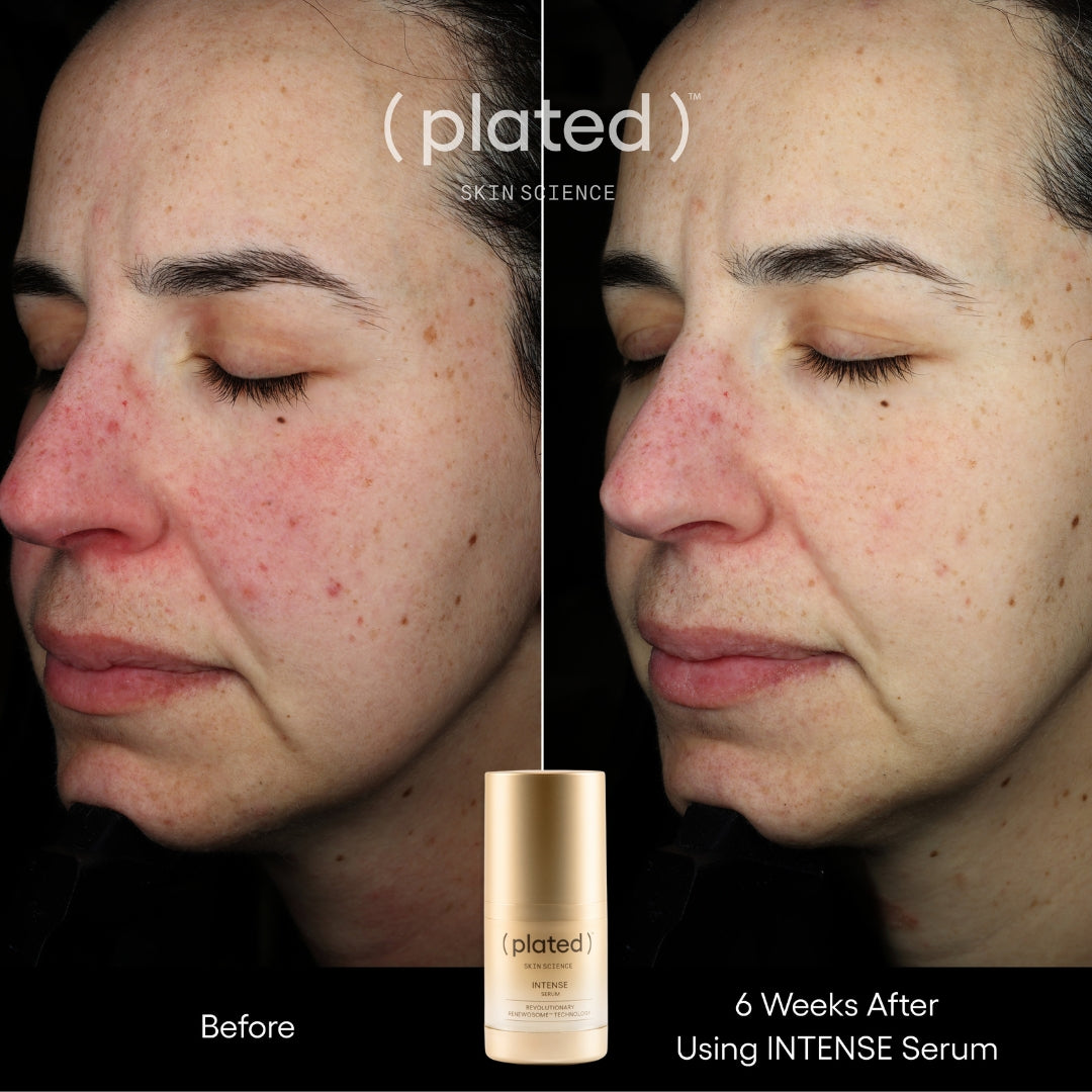 ( plated )™ Intense Serum