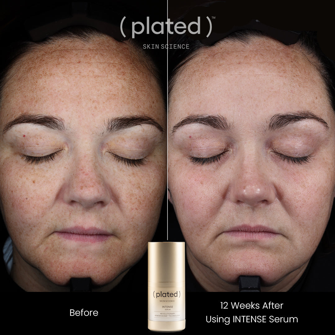 ( plated )™ Intense Serum