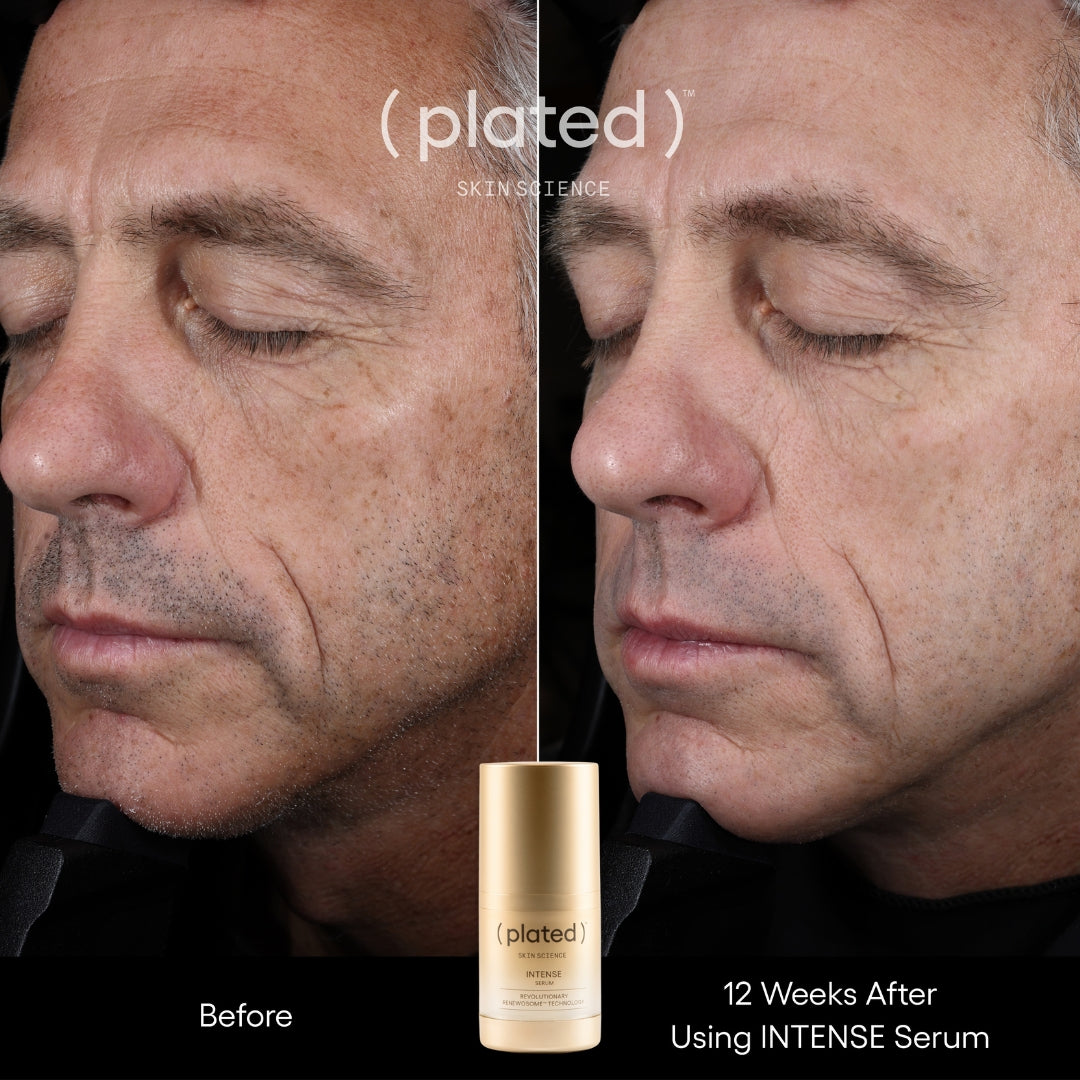 ( plated )™ Intense Serum