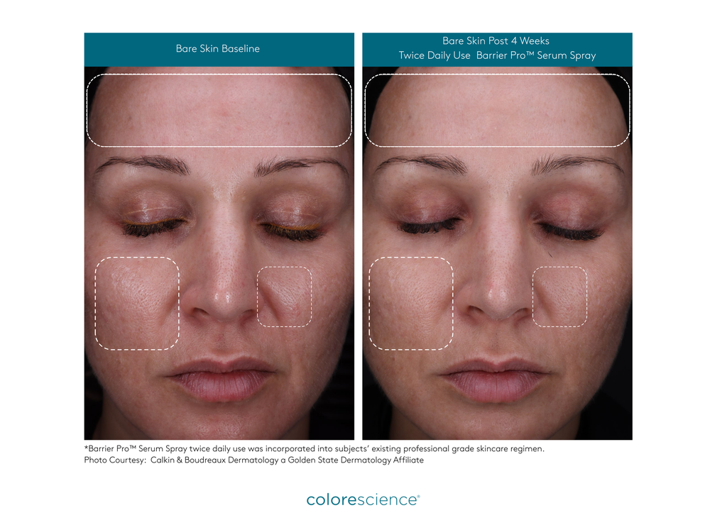 Barrier Pro™ Serum Spray