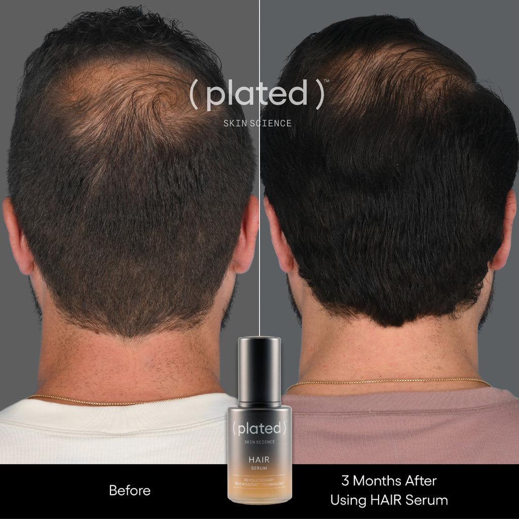 ( plated )™ HAIR Serum